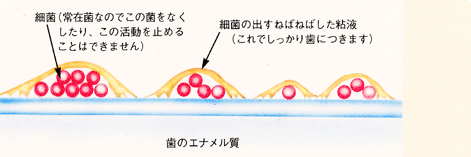 プラークはどのようにできる?